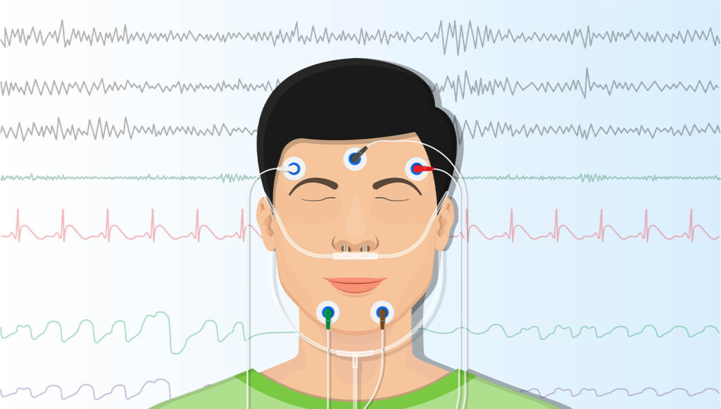 Narcolepsy Test | Do You Have A Sleep Disorder?